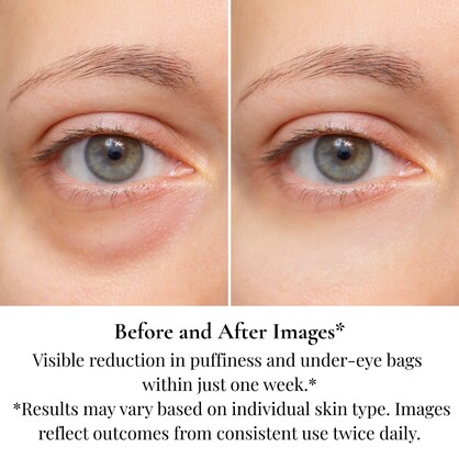 Anti-Aging Complete Eye Contour Set